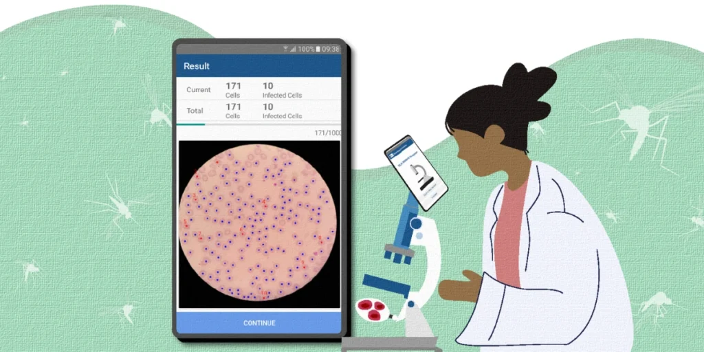 AI Boosts Malaria Diagnosis